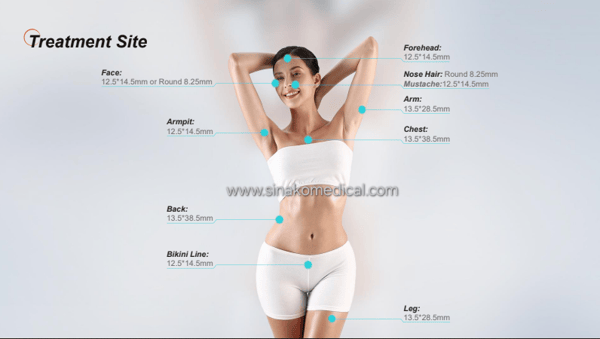 P-808 diode laser body treatment area