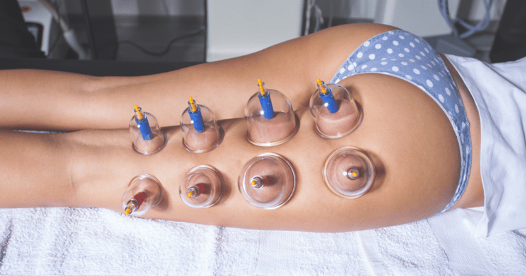 ¡Prepárense para una revelación que va a cambiar su rutina de bienestar! 🧘‍♀️  ¡Soy FAN de las terapias naturales y, créanme, este kit de ventosas con bomba de succión es lo más! La imagen me revela un set práctico y moderno de copas de ventosa de plástico transparente, con un aplicador de vacío manual (la "pistola") que lo hace súper fácil de usar incluso si eres principiante. ¡Miren esos topes verdes, le dan un toque pro!  Lo que más me gusta de este producto es que te permite traer un antiguo y poderoso tratamiento de bienestar directamente a la comodidad de tu casa. Es como tener a tu propio terapeuta a mano para esos días de tensión, ¡y todo sin tener que pedir cita! La transparencia de las copas es genial porque te permite ver exactamente cómo está trabajando sobre tu piel.