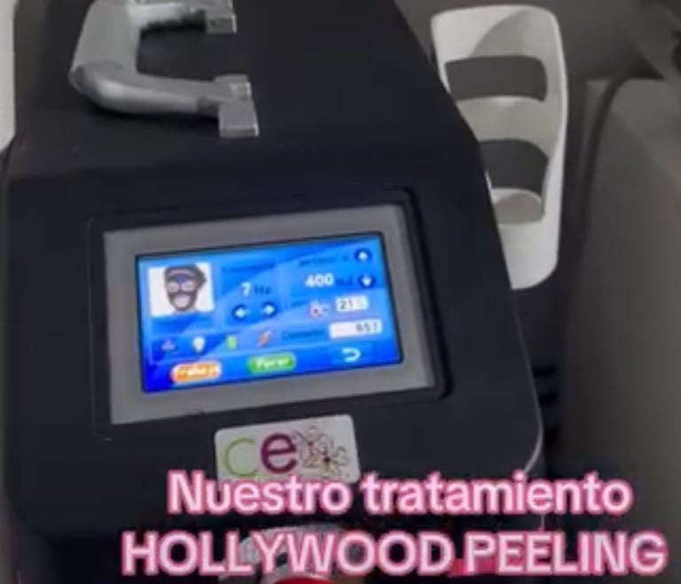 Galería 2