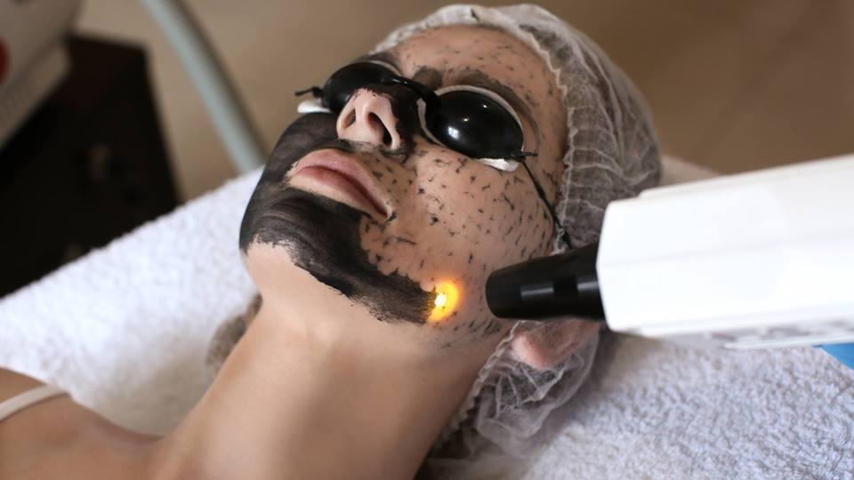 Peeling węglowy (BLACK DOLL)