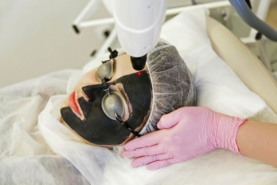 Peeling węglowy (BLACK DOLL)