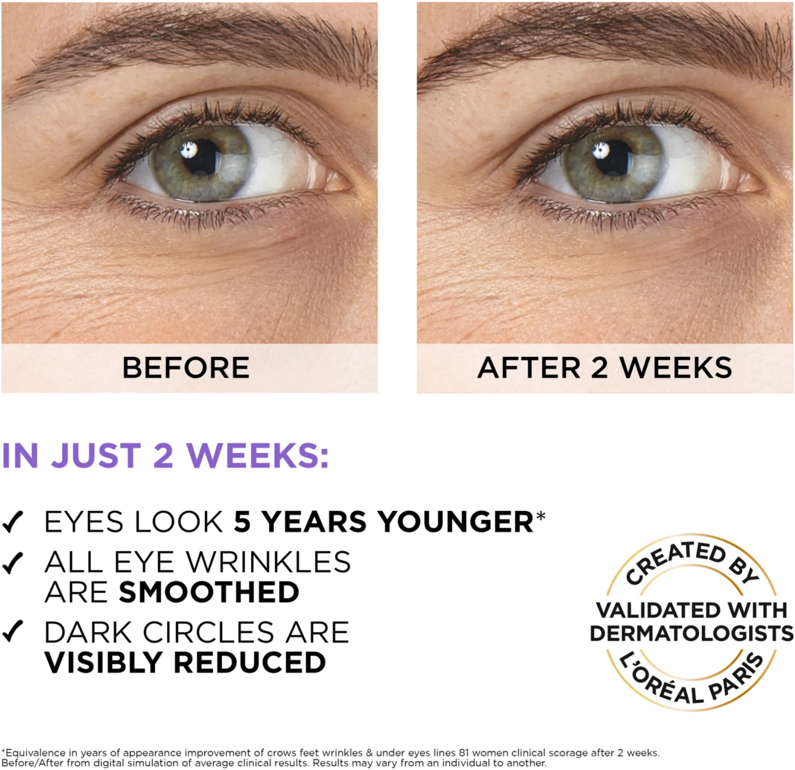 L'Oréal - Sérum Contour des Yeux - Anti-Rides , Anti-Poches & Anti-Cernes - Acide Hyaluronique + Caféine - Triple-Bille innovant - Revitalift Filler Hyaluron - 20 ml