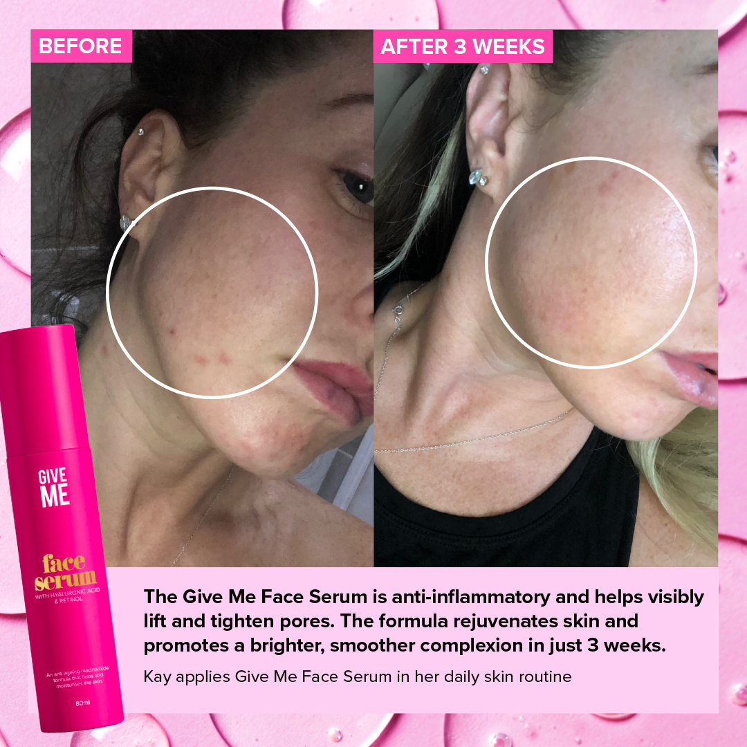 Hyaluronic Acid & Retinol Face Serum