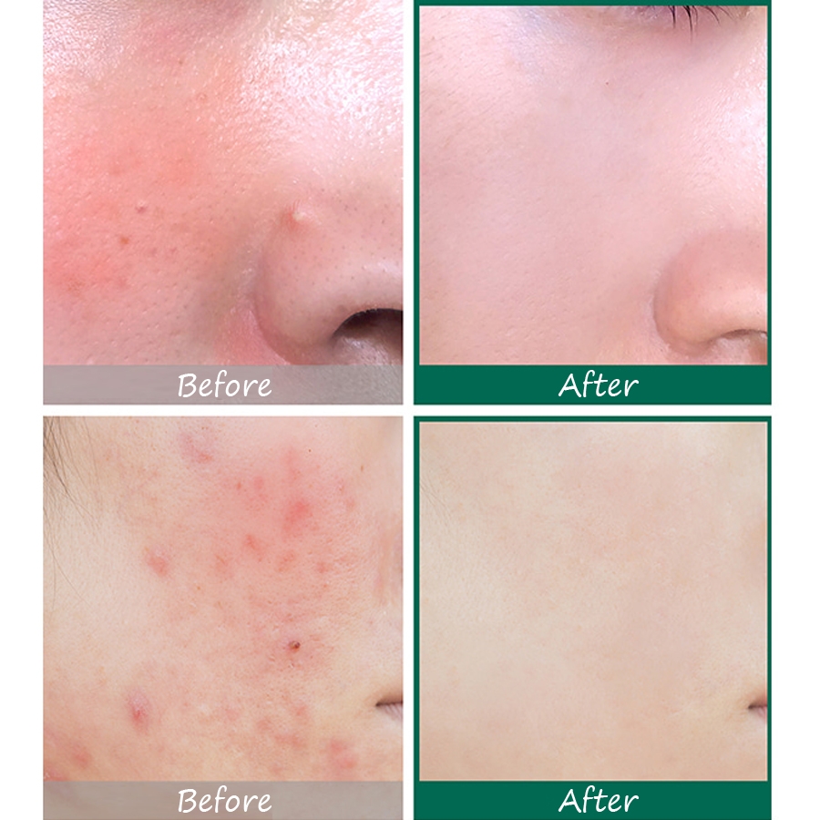 SOME BY MI AHA BHA PHA 30 days Miracle Serum