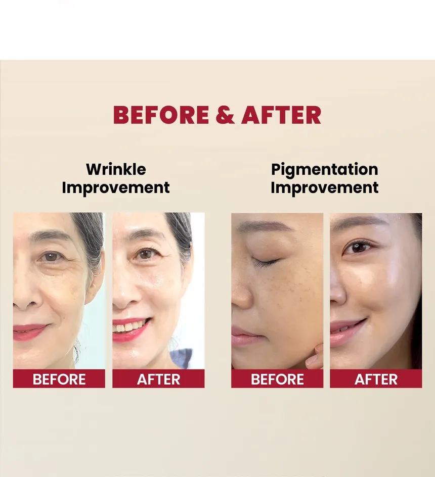 KSECRET SEOUL 1988 SERUM : RETINAL LIPOSOME 2% + BLACK GINSENG 