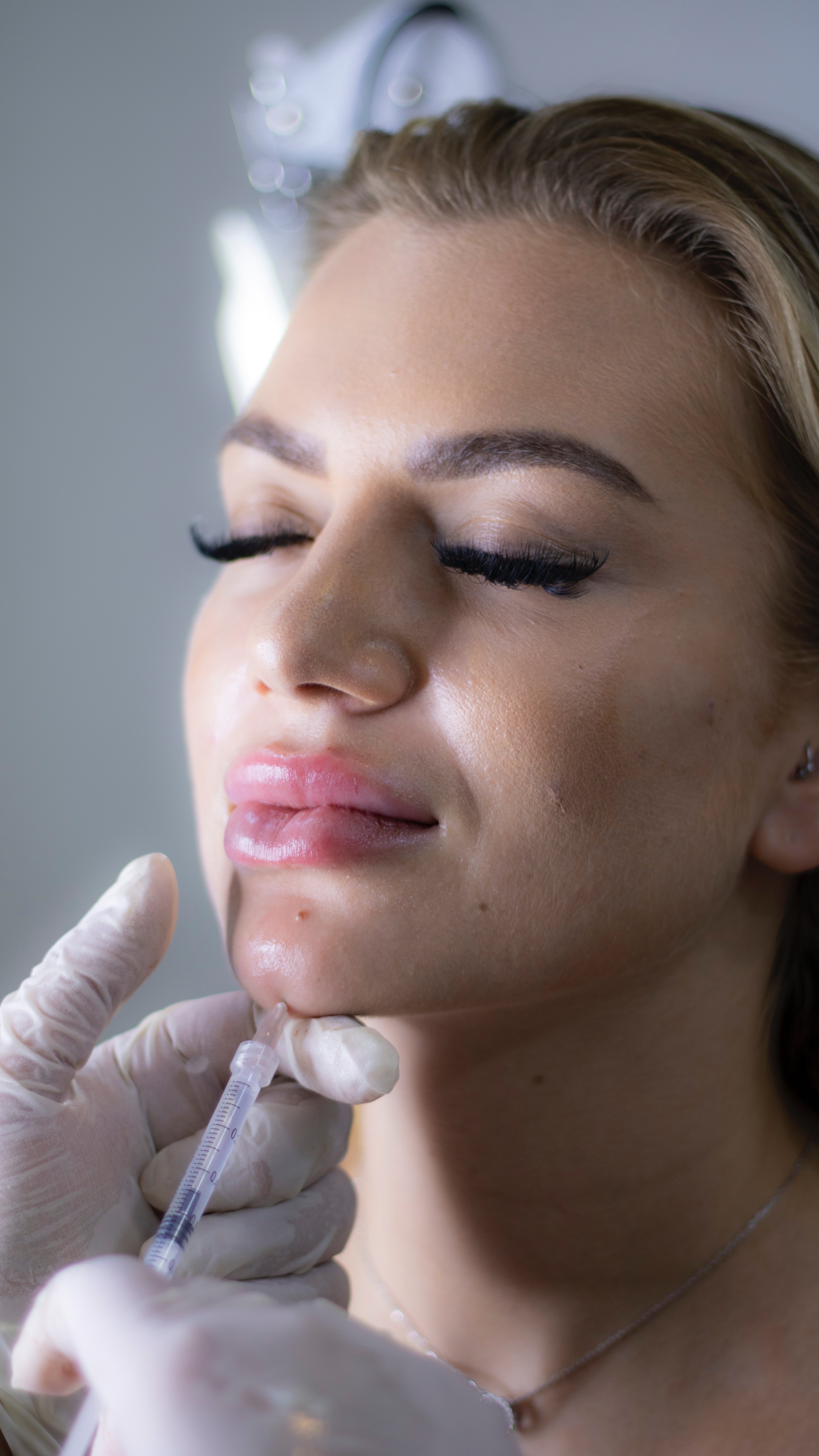 Dermal filler 