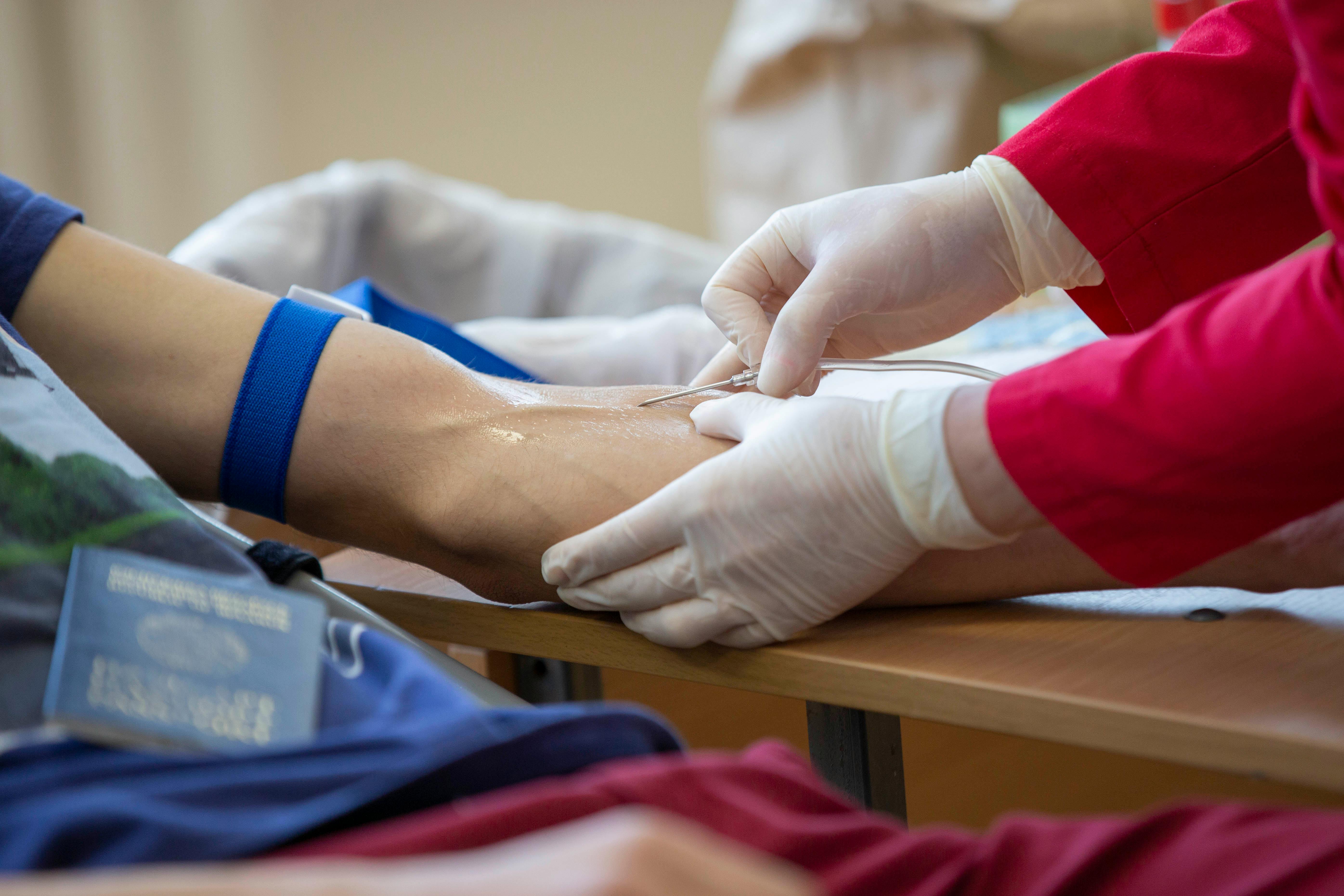 Platelet Rich Plasma Treatment