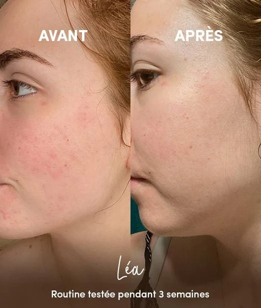 Nettoyant Visage Anti-Imperfections en Poudre BIO