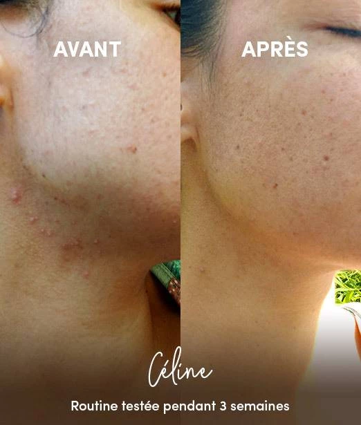 Nettoyant Visage Anti-Imperfections en Poudre BIO