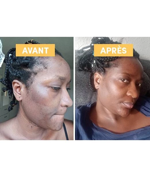 Macérat huileux de Busserole