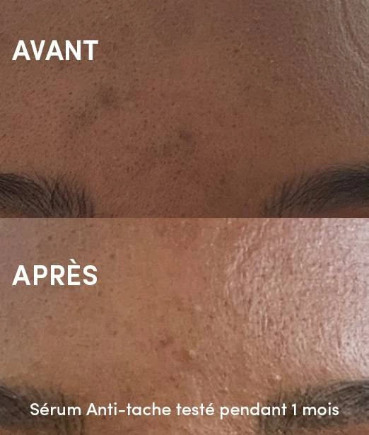 Sérum Anti-Tache