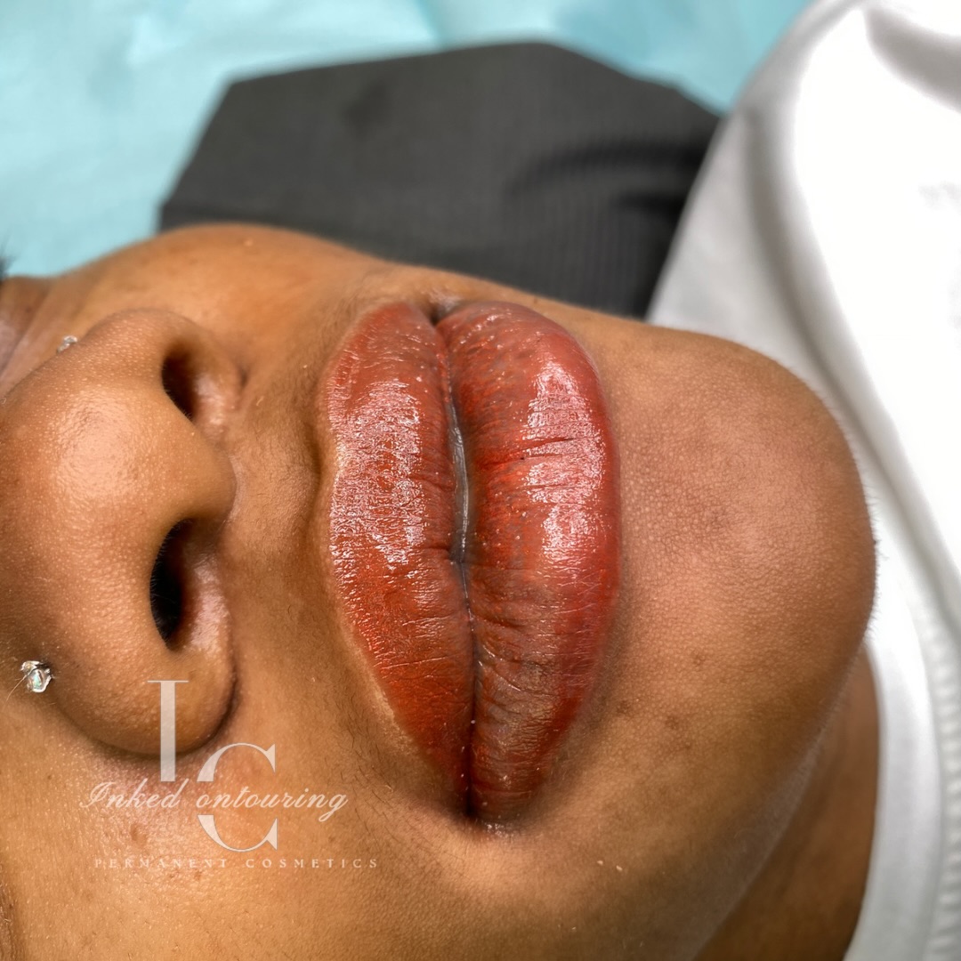 Lip Neutralization (first session + touchup included)