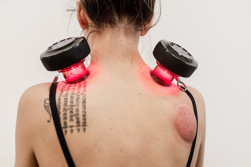 Dynamic Cupping With Red Light Therapy