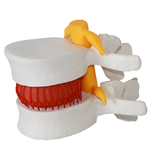 Human Lumba Disc Demonstration Model