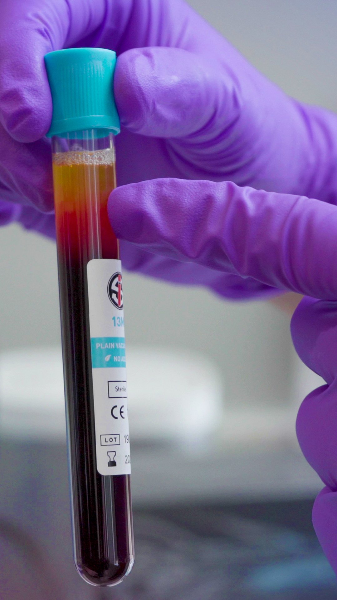 EZGel Biofiller One Treatment