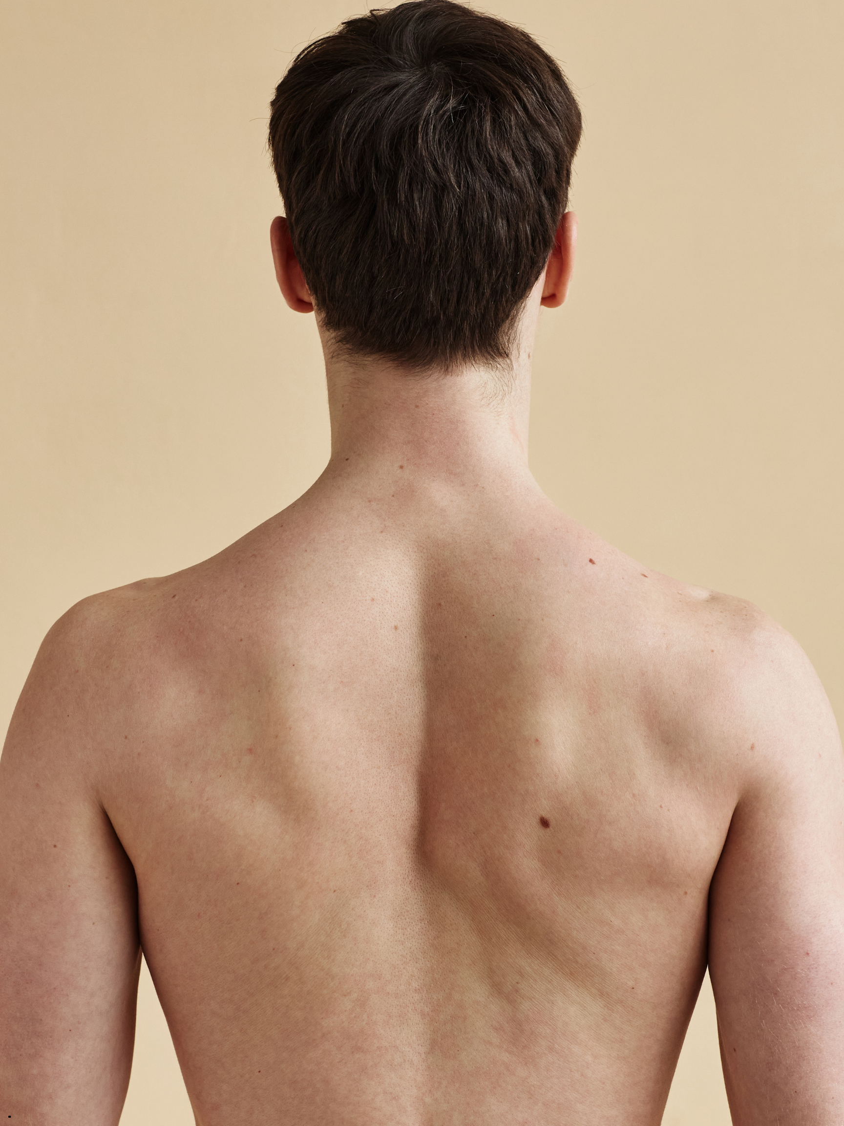 Laser Hair Removal- Full Back 