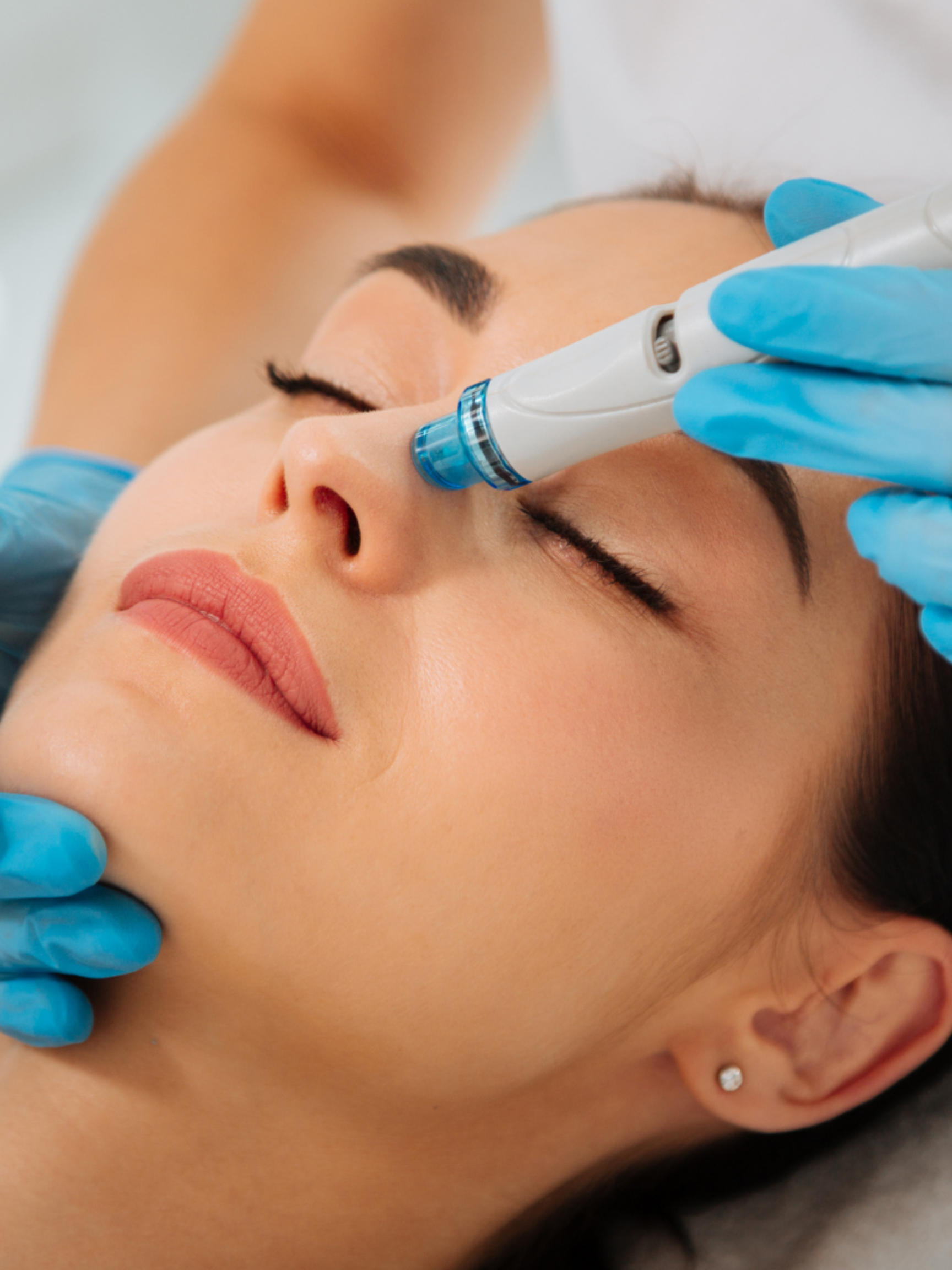 Package of 3 HydraFacial's 