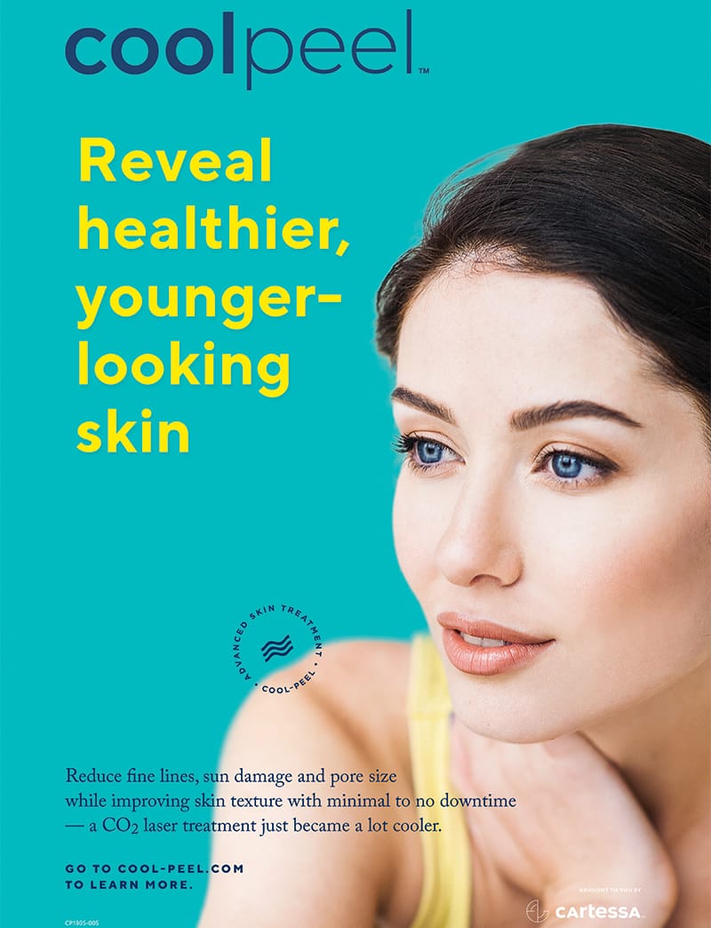 CoolPeel C02 Laser Face 