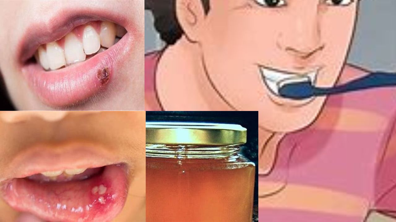 the way of Dr. Hassan Al-Waraqi of Sore throat treatment  طريقة الدكتور حسن الوراقي في علاج التهاب الحلق