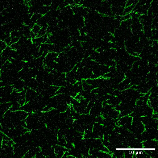 Recombinant beta Actin (ACTB) Human Recombinant Protein