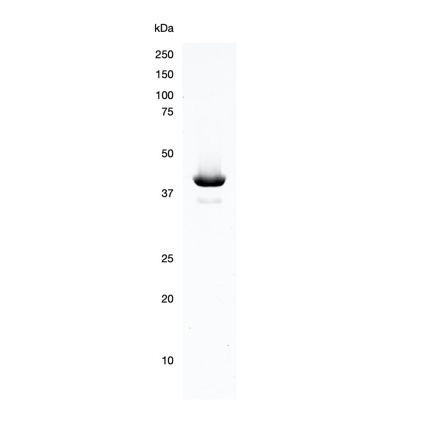 Recombinant Cardiac Actin (ACTC1) Recombinant Human Protein
