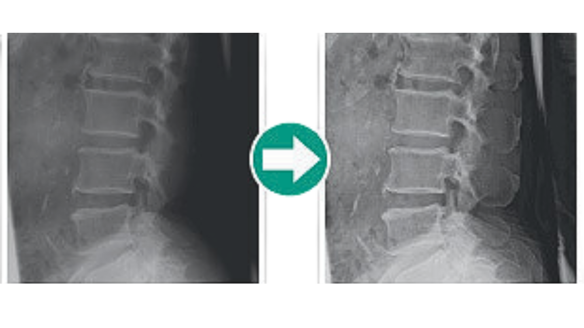 DIGITALIZADOR FUJIFILM FCR PRIMA II