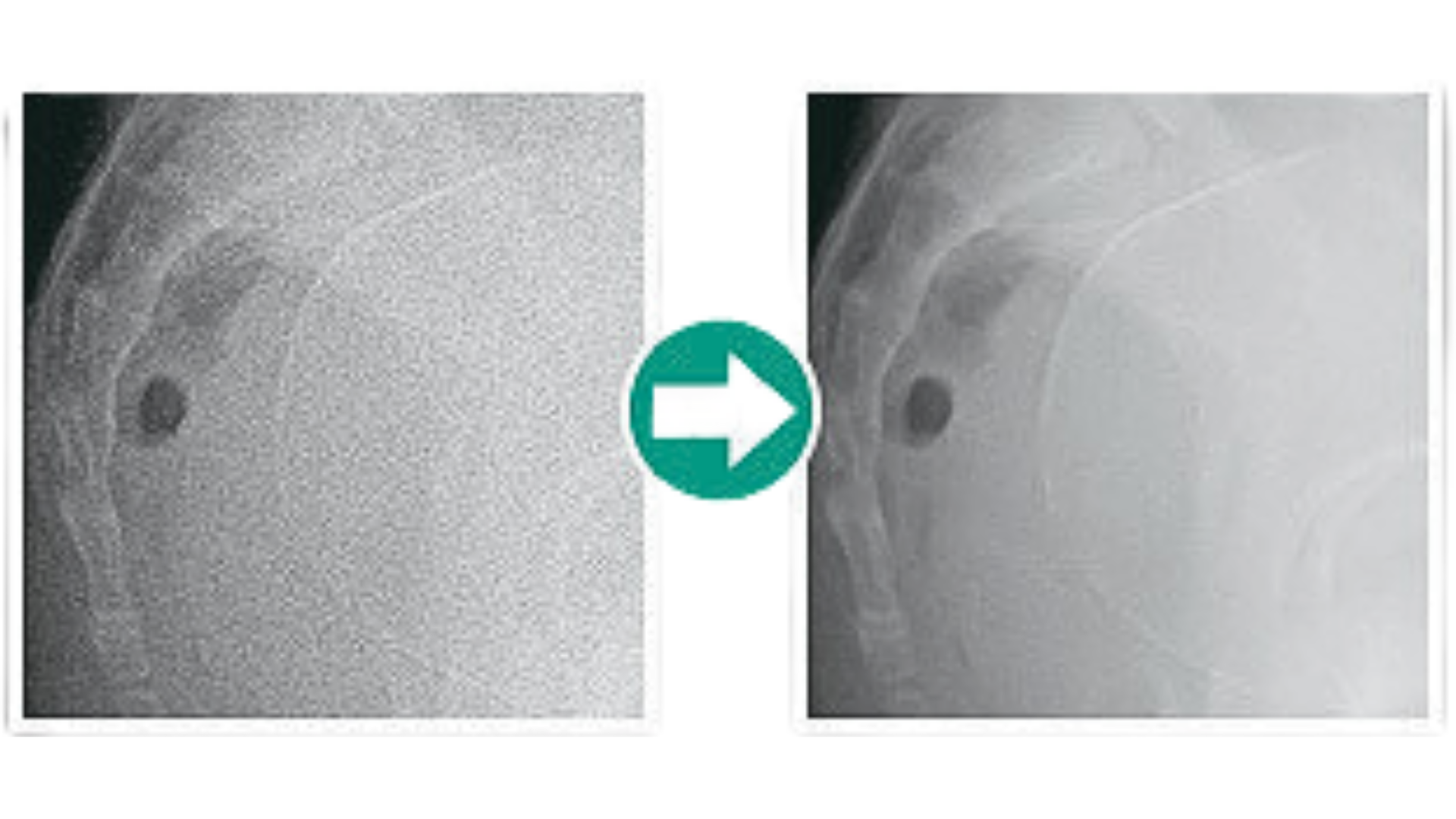 DIGITALIZADOR FUJIFILM FCR PRIMA II