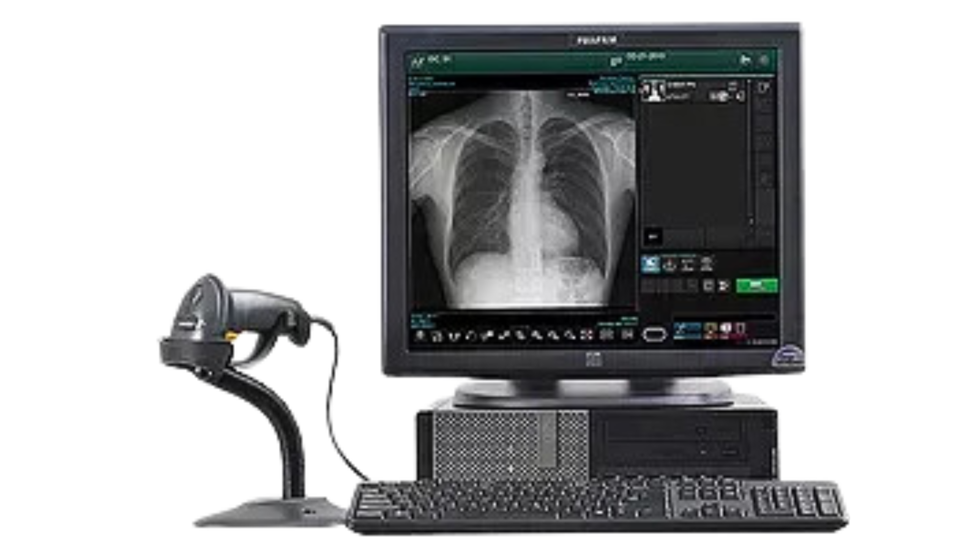 DIGITALIZADOR FUJIFILM FCR PRIMA T2 