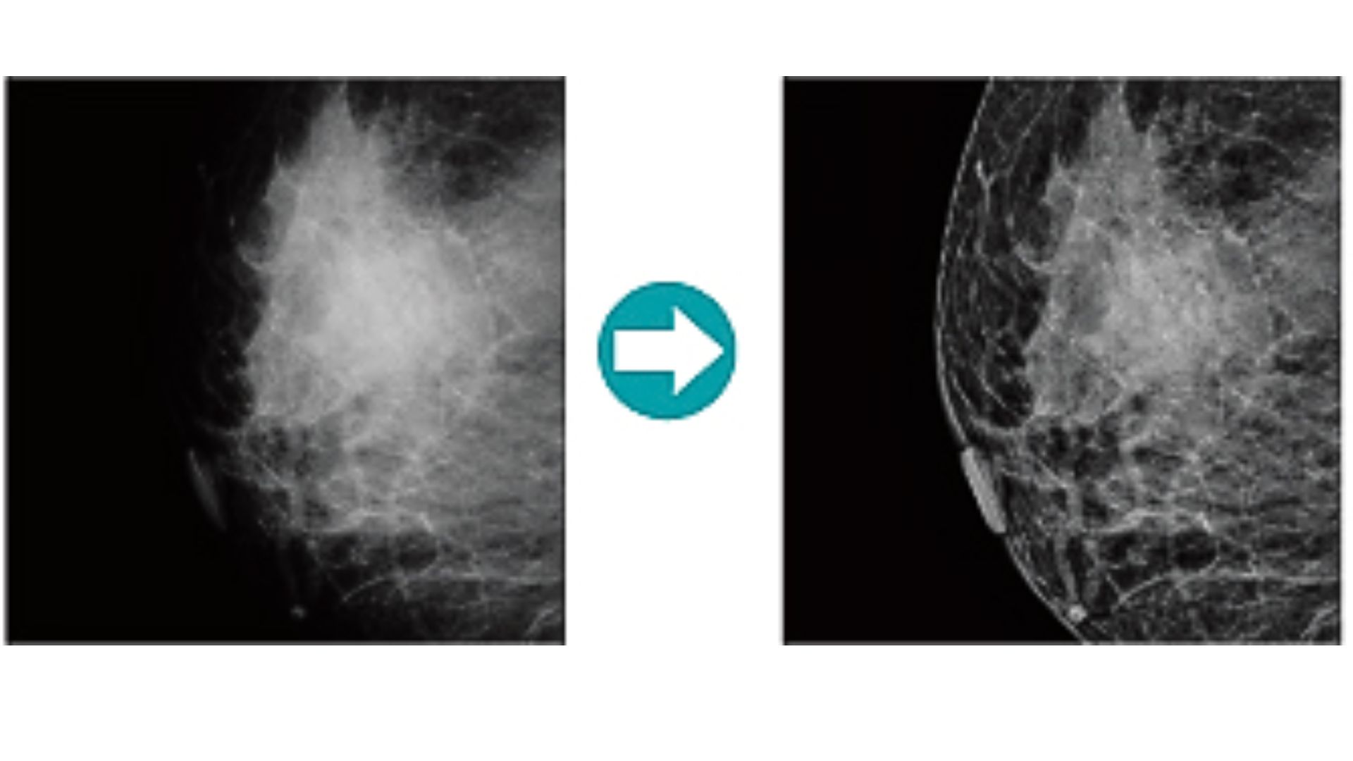 DIGITALIZADOR FUJIFILM PRIMA TM