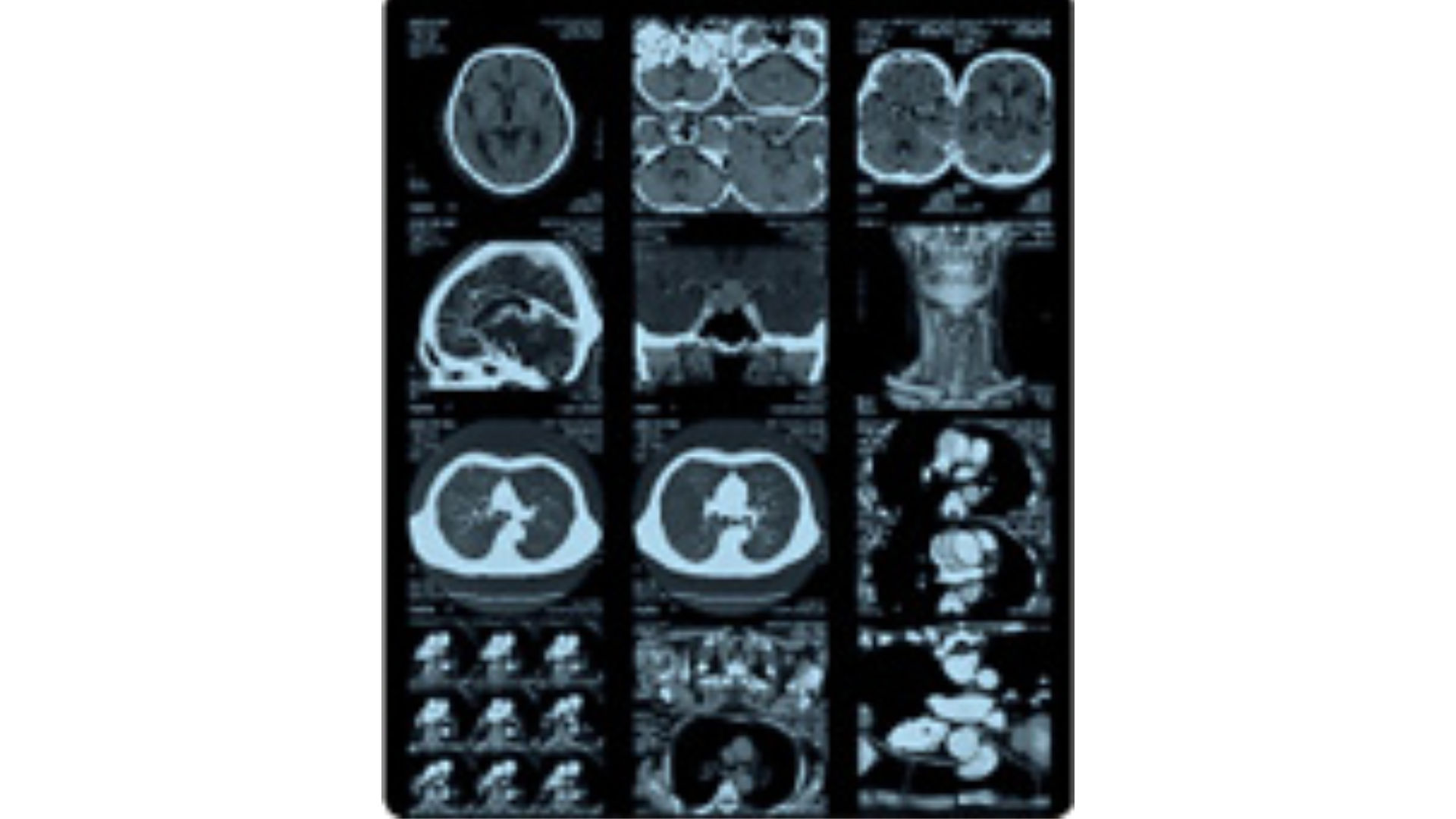 IMPRESORA LÁSER FUJIFILM DRYPIX SMART