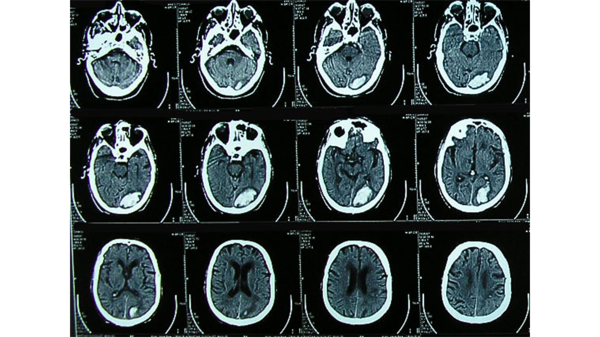 TOMÓGRAFO FUJIFILM FCT SPEEDIA