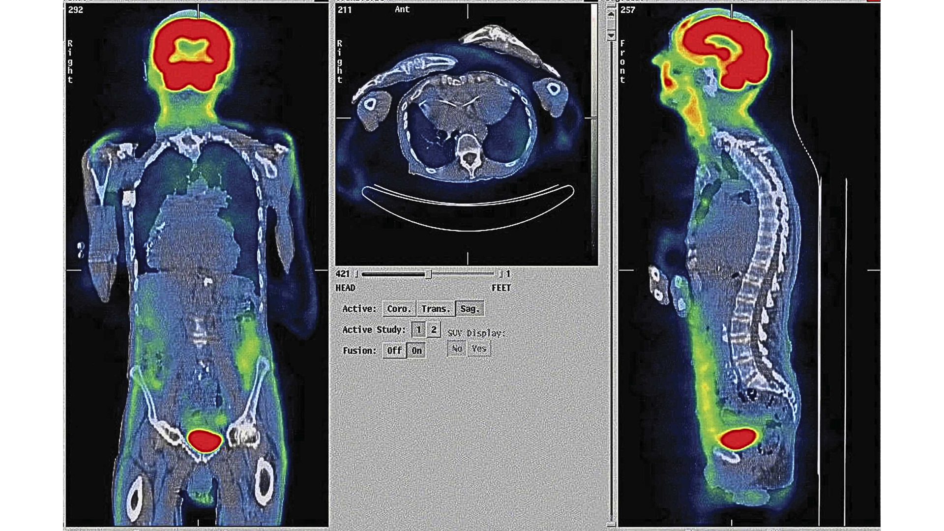 TOMÓGRAFO FUJIFILM FCT SPEEDIA