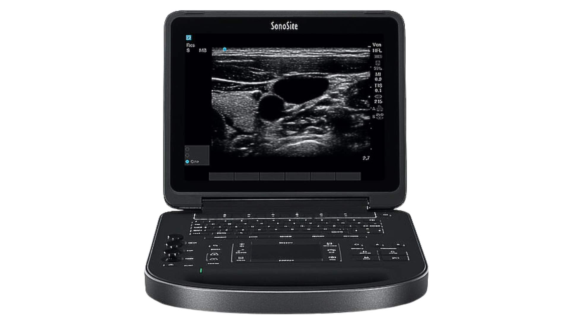 SonoSite Edge II Fujifilm