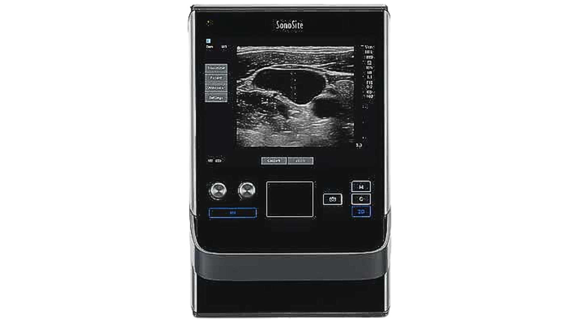 SonoSite SII Fujifilm