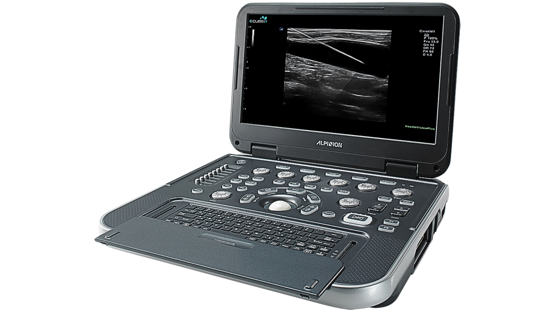 ULTRASONIDO PORTATIL  ALPINION E-CUBE I7