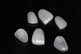 Facetas laminadas