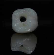 Coroas sobre implantes