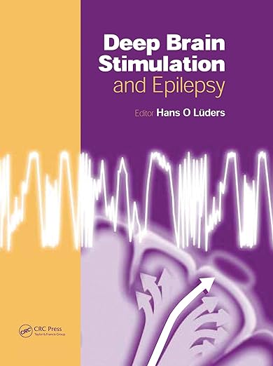 Deep Brain Stimulation and Epilepsy 1st Edition