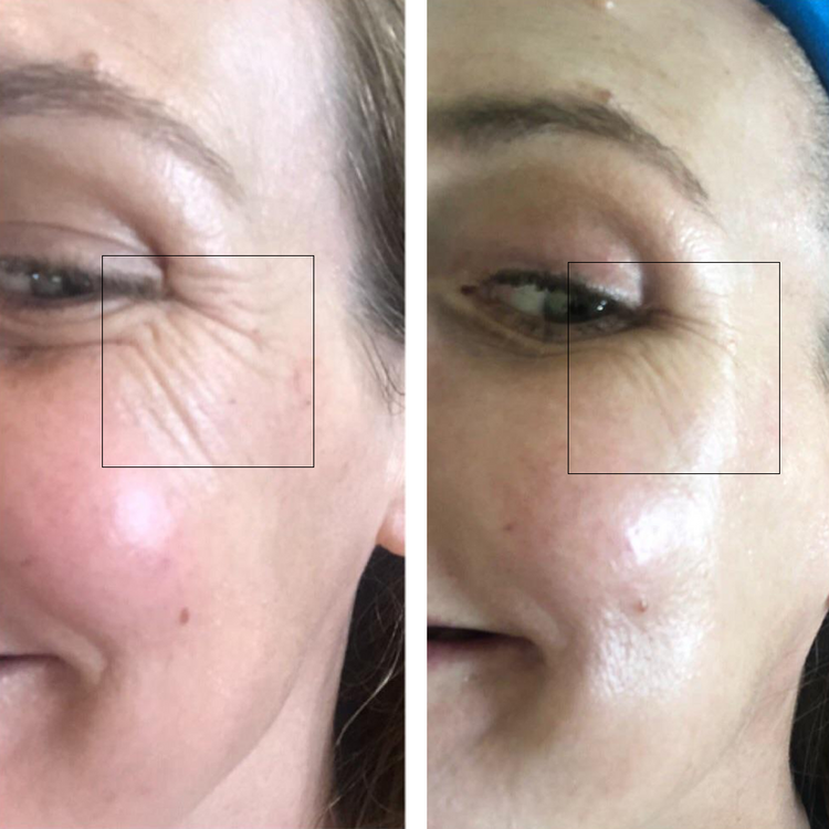 Wrinkle Free moisturizer 