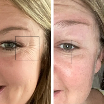 Wrinkle Free moisturizer 