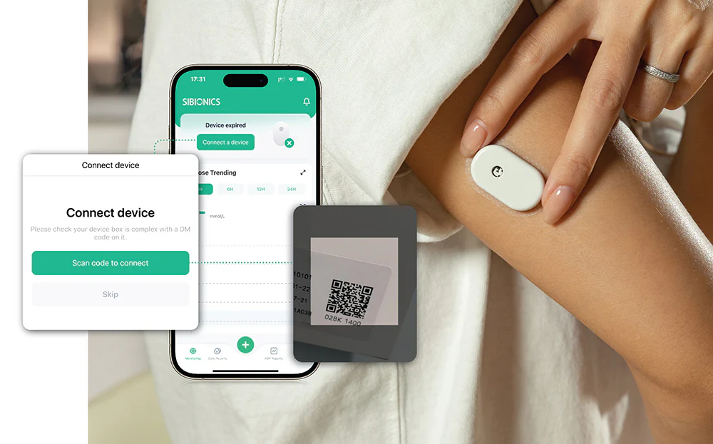 Gliukomatis SIBIONICS