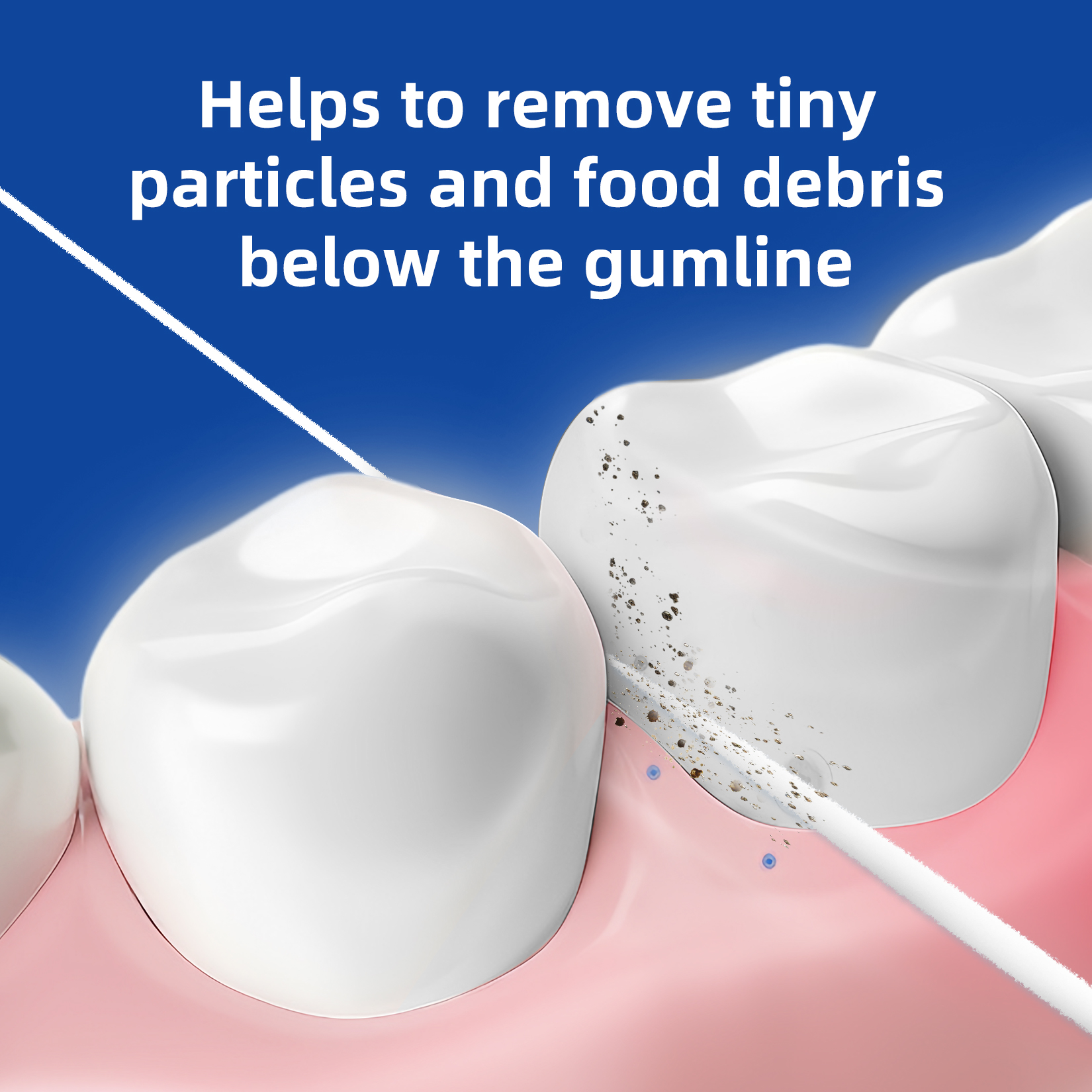 Dental Floss for Braces, Floss Threaders for Bridges and Implants 80 Pre-Cut Strands (Pack of 2)