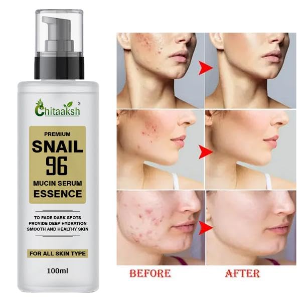 Snail 99 Mucin Serum for Face - Contains 99% Snail Secretion Filtrate & Hyaluronic Acid - Intense Hydration, Blemishes, Wrinkles & Spot Correction, Anti Ageing, Skin Firming - All Skin Types - 100 ML