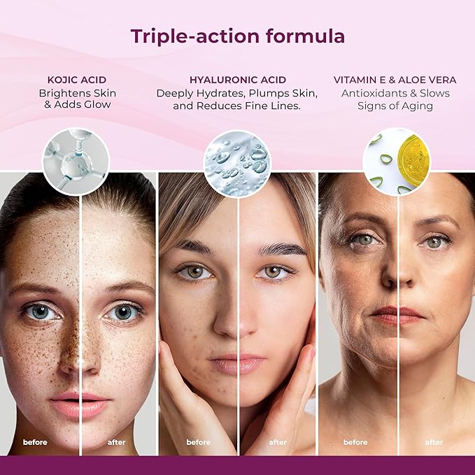 Kozicare Kojic Acid Cream with Hyaluronic Acid & Vitamin E | Lightweight Moisturizer with SPF 50 | Nourishing for All Skin Types | Achieve Radiant, Flawless Skin | Perfect for Women & Men - 50 gm