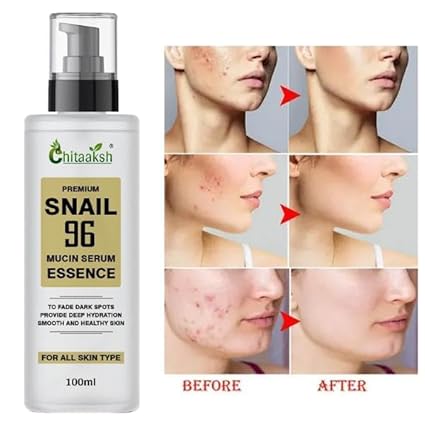 Snail 99 Mucin Serum for Face - Contains 99% Snail Secretion Filtrate & Hyaluronic Acid - Intense Hydration, Blemishes, Wrinkles & Spot Correction, Anti Ageing, Skin Firming - All Skin Types - 100 ML