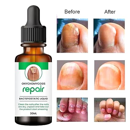 100% Natural Profesional Serum For Nail Strong, Supple and Shaped Nail Care Serum Pack OF 1