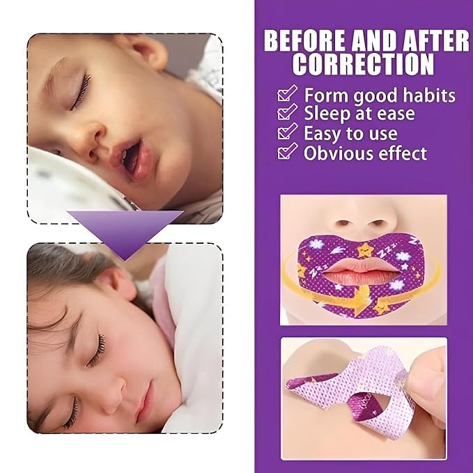 30 Pcs Gentle Sleep Mouth Tape, Hypoallergenic Anti-Snoring Strips