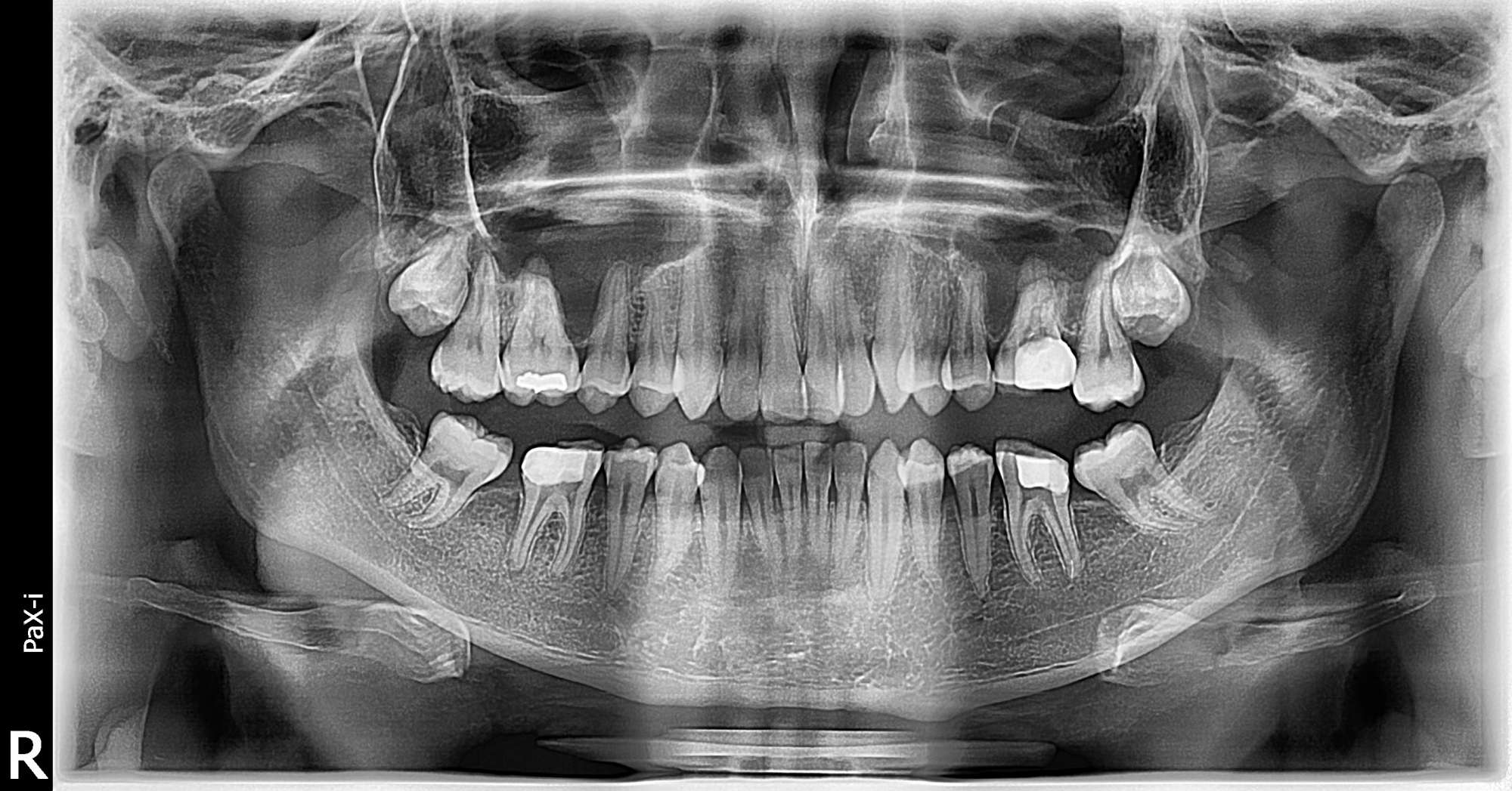 Vatech PaX-i SC Used Dental Pano+Ceph