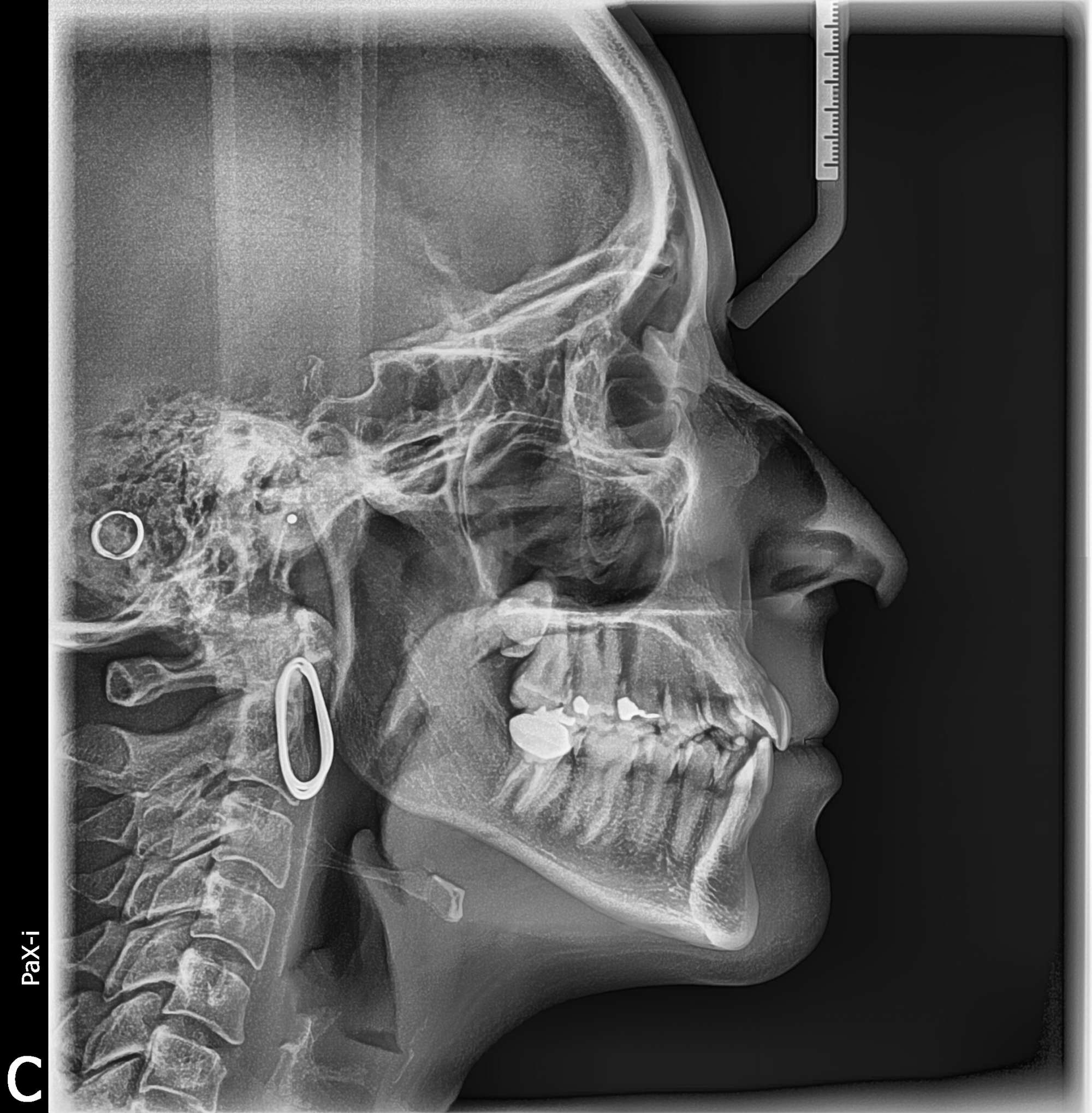 Vatech PaX-i SC Used Dental Pano+Ceph