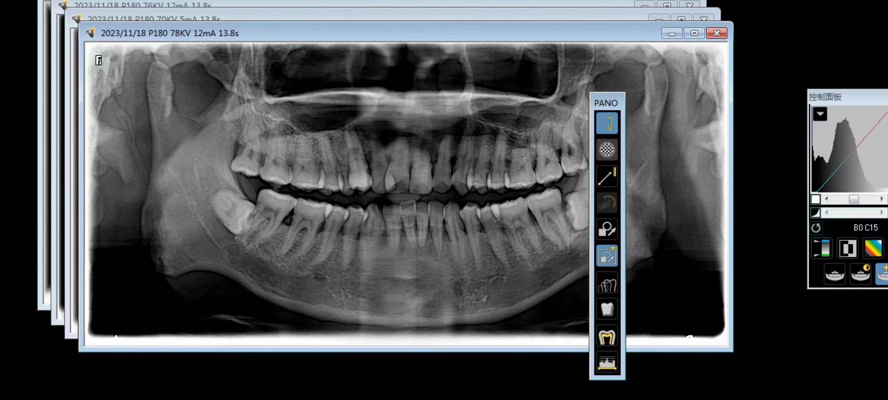 Carestream CS8000C Used Dental Pano+Ceph